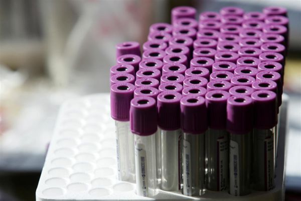 מכון פוע"ה: עוד לא קם הפוסק שיתיר תרומת זרע