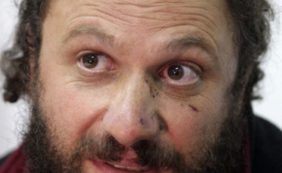 נועם פדרמן זכאי בפעם ה-46. זוכה מתקיפת פעיל שמאל בקרית ארבע