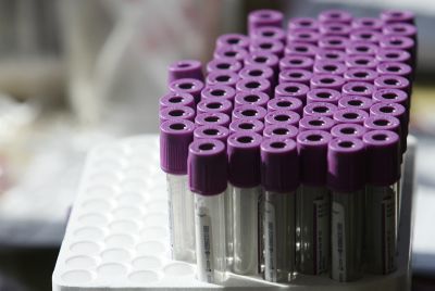 שלוש בנות שירות לאומי נמצאו מתאימות לתרומת מח עצם