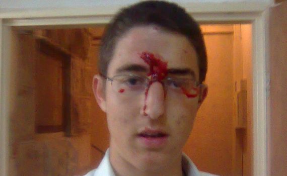 אתמול במזרח ירושלים, כמעט לינץ' במשפחה ישראלית