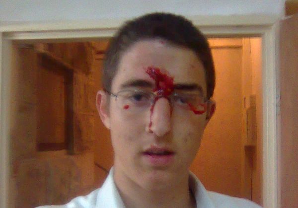 אתמול במזרח ירושלים, כמעט לינץ' במשפחה ישראלית