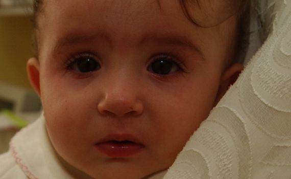 הדרך הטבעית למניעת והקלת אלרגיה אצל ילדים