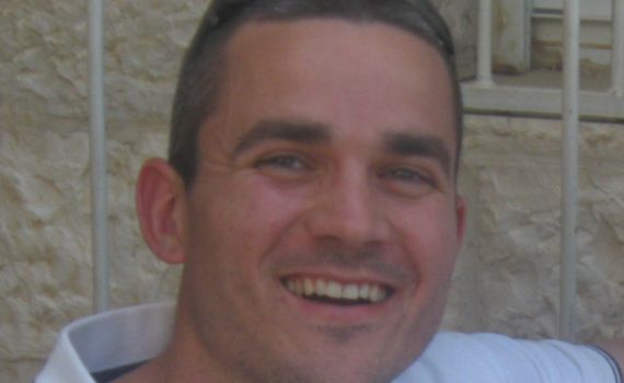 בדיקת הסי.טי. הוכיחה: אשר פלמר הי"ד נפגע מסלע בפניו