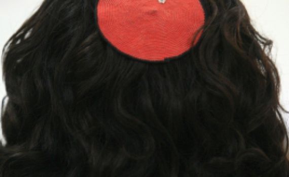 דעה: בניגוד לאדמת ולחזרת דתל"שת אינה מחלה