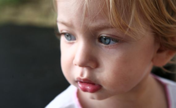 טיפים: כך תשמרי על עורך מנזקי החורף