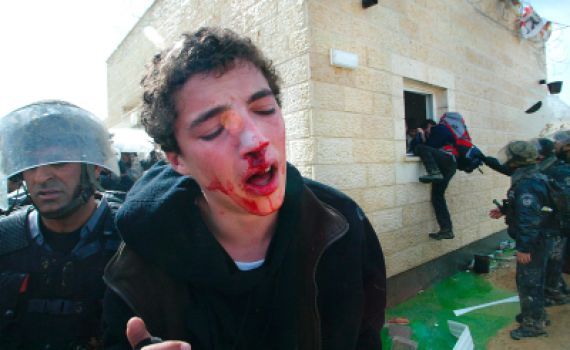 שש שנים לפוגרום בעמונה: סרטון קשה לצפייה