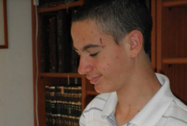 נעדר: דרושה עזרת הציבור בחיפוש אחר נער בירושלים