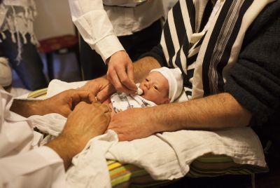 הניתוח הכי בטוח בעולם: הסיכון בברית מילה 0.06%