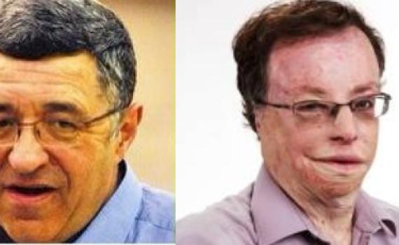 פרסום ראשון: הגוש הדתי לאומי בירושלים התאחד; לראשונה סגנית ראש עיר דתייה