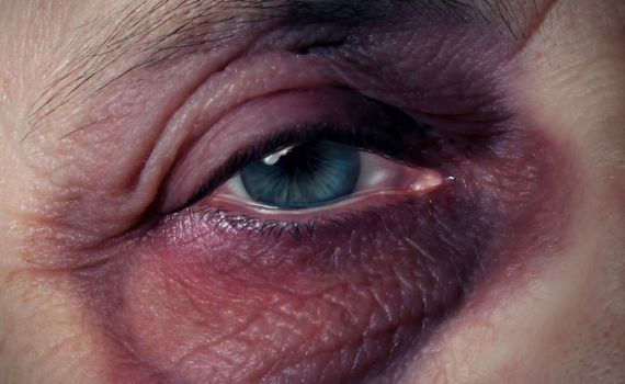 חשד: תוקפי הקשישות בחולון – ילדים בני 12