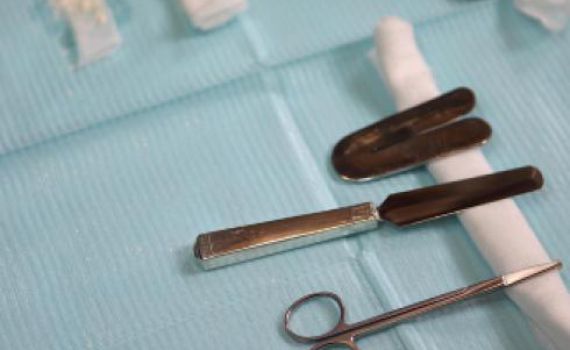 אישה סירבה למול את בנה – וספגה קנס