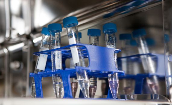 עוברת טיפולי פוריות? כך תשמרי על זוגיות שפויה