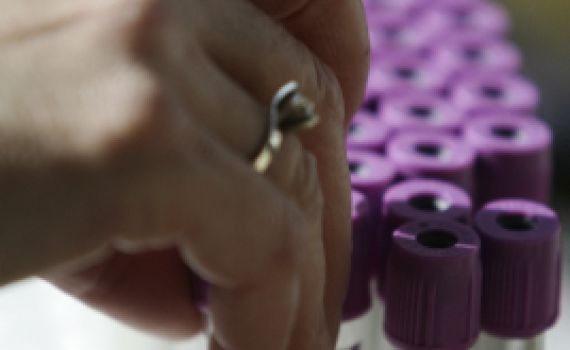 חותם: "בדיקות גנטיות לילודים – לא בכל מחיר"