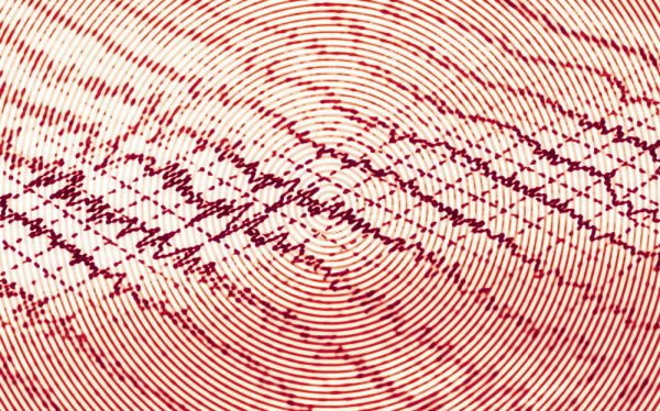 חולה אפילפסיה יכול להוציא רישיון? ● מיתוסים על מחלת הנפילה