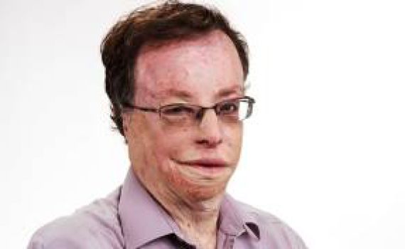 קלמנוביץ לברקת: אל תתן את גבעת מרדכי לחרדים