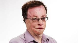 קלמנוביץ לברקת: אל תתן את גבעת מרדכי לחרדים