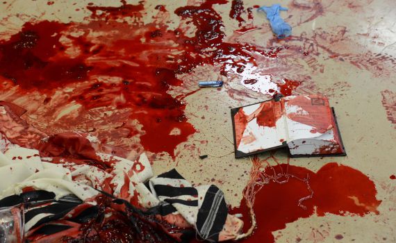 "ערבים, יריות, ראיתי דם וברחתי משם"