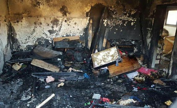 תינוק פלסטיני נספה בהצתת בית בכפר דומא