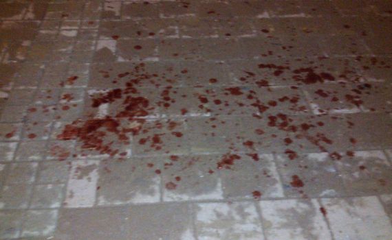 פיגוע דקירה באריאל; המחבל הצליח לברוח