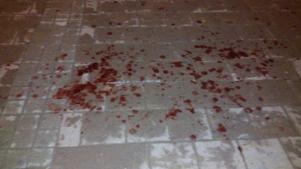 פיגוע דקירה באריאל; המחבל הצליח לברוח