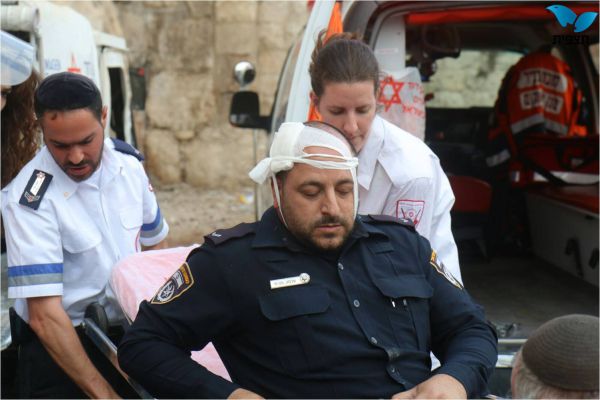 לא נגמר: שוטר נפגע בראשו מיידוי אבנים