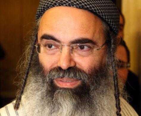 "יש פיגועי דקירה כי אוכלים מסכינים פגומות"