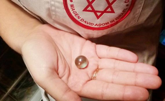 אסון בבני ברק: נפטר הפעוט שבלע גולה ונחנק