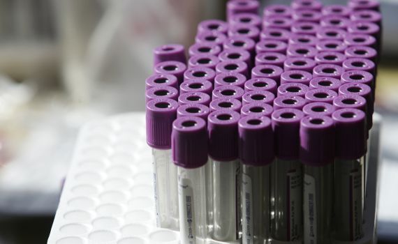 רבני הסרוגים לצעירים: "בצעו בדיקת דור ישרים"