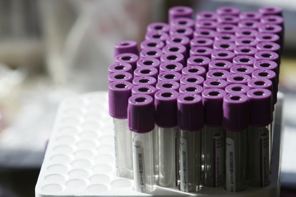 רבני הסרוגים לצעירים: "בצעו בדיקת דור ישרים"