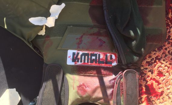 פיגוע דקירה בשער יפו; פצוע אנוש מירי בשוגג