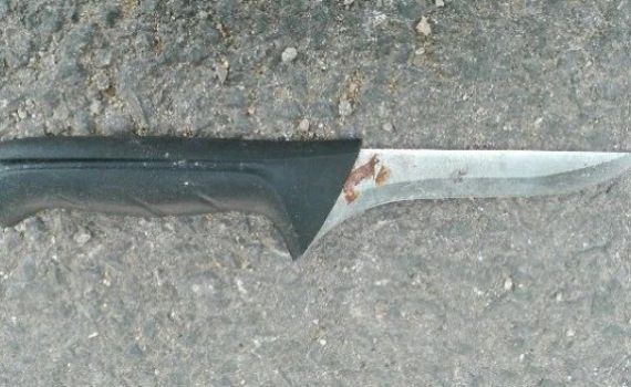 שני שוטרים נפצעו בפיגוע ירי ובפיגוע דקירה