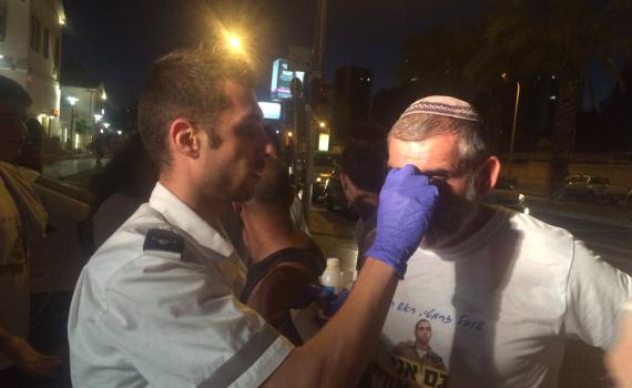 שמאלנים תקפו בחומצה צעדת תמיכה באלאור