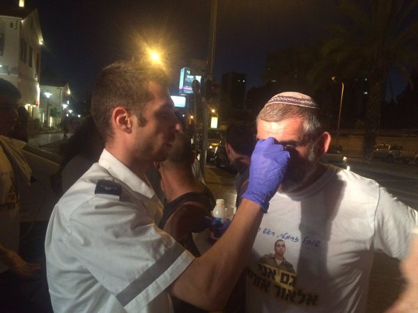 שמאלנים תקפו בחומצה צעדת תמיכה באלאור