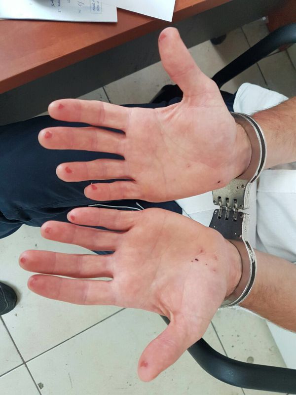 נתפס וחתך את האצבעות כדי למנוע זיהוי. צפו