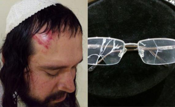 הרב שהתבטא נגד הרב ברלנד חטף מכות באומן