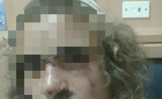 קטין שנפצע בפשיטה על הישיבה פונה לביה"ח