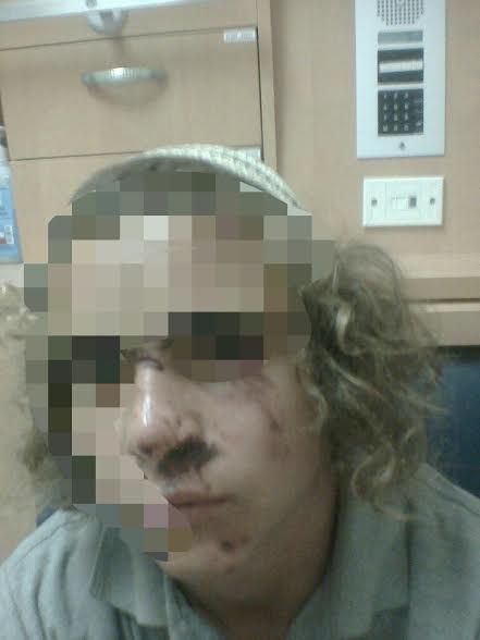 קטין שנפצע בפשיטה על הישיבה פונה לביה"ח