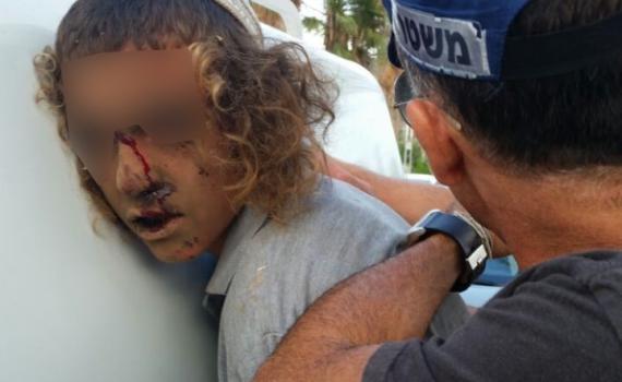 "די לאבדן העשתונות שמלווה את המאבק בתג מחיר"