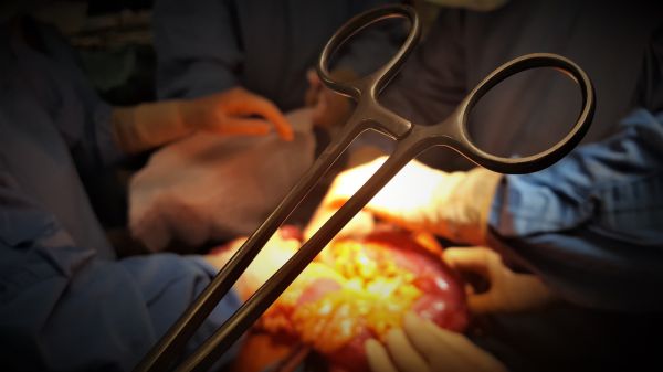 עמותה המסייעת להשתלות אברים חשודה בקבלת שוחד