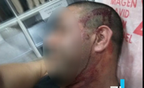 מפחיד: סירב להסיע למצעד הגאווה והותקף קשות. צפו