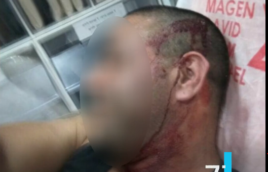 מפחיד: סירב להסיע למצעד הגאווה והותקף קשות. צפו