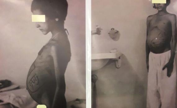 מזעזע: בתי החולים ביצעו ניסויים בילדי תימן החטופים