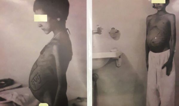 מזעזע: בתי החולים ביצעו ניסויים בילדי תימן החטופים