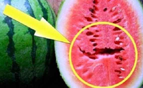 הרשת נסערת בגלל סכנה חדשה ומדאיגה באבטיחים