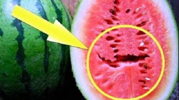 הרשת נסערת בגלל סכנה חדשה ומדאיגה באבטיחים