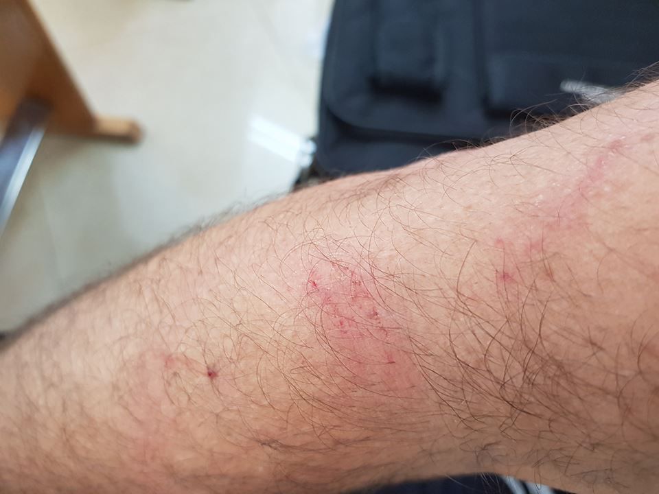 תקיפת ראש העיר לוד: מה קרה שם באמת?