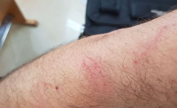 תקיפת ראש העיר לוד: מה קרה שם באמת?