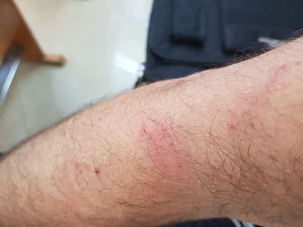 תקיפת ראש העיר לוד: מה קרה שם באמת?