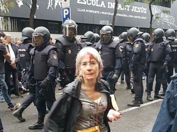 תוצאות קשות במהומות בקטלוניה: 465 פצועים