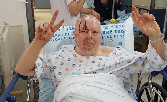 'נס גדול' • אחד הפצועים: אביה של אלישבע פדרמן